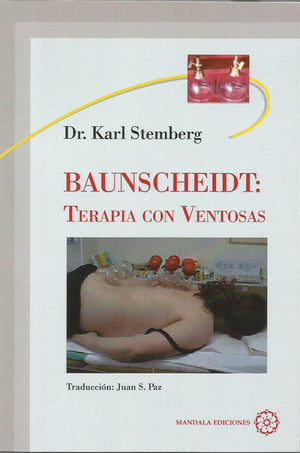 Baunscheidt:  Terapia Con Ventosas